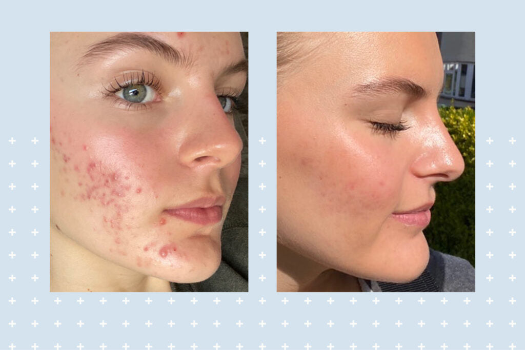 Zashya Youth Collagen Cream
