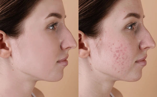 Zashya Youth Collagen Cream