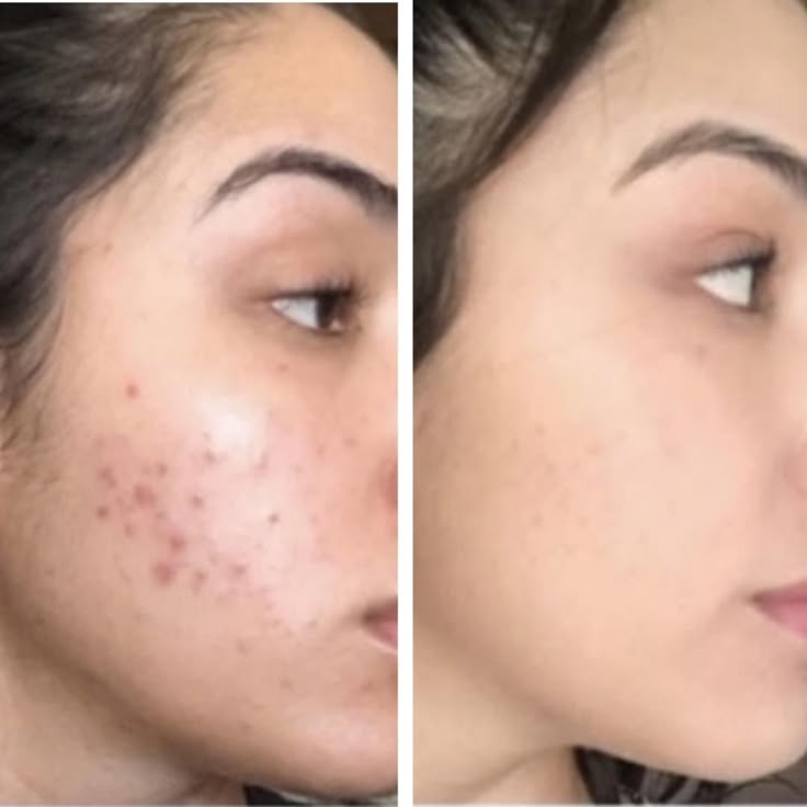 Zashya Collagen Pearl Cream