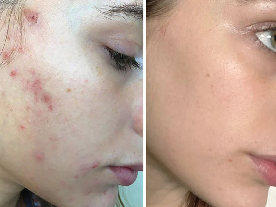 Zashya Collagen Pearl Cream