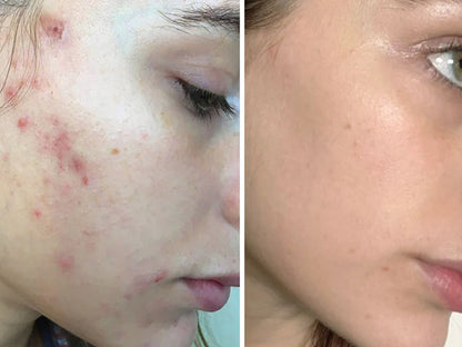 Zashya Collagen Pearl Cream