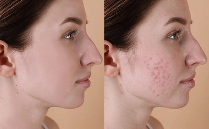 Zashya Youth Collagen Cream