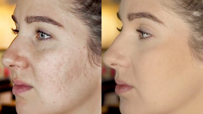 Zashya Youth Collagen Cream